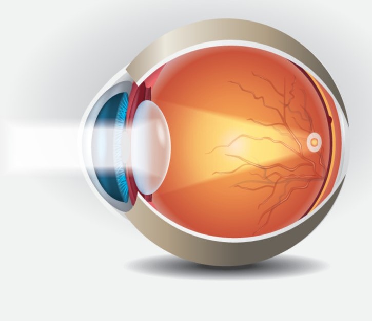 The human eye shows clear lens after successful cataract surgery and treatment by Stephanie West in the UK