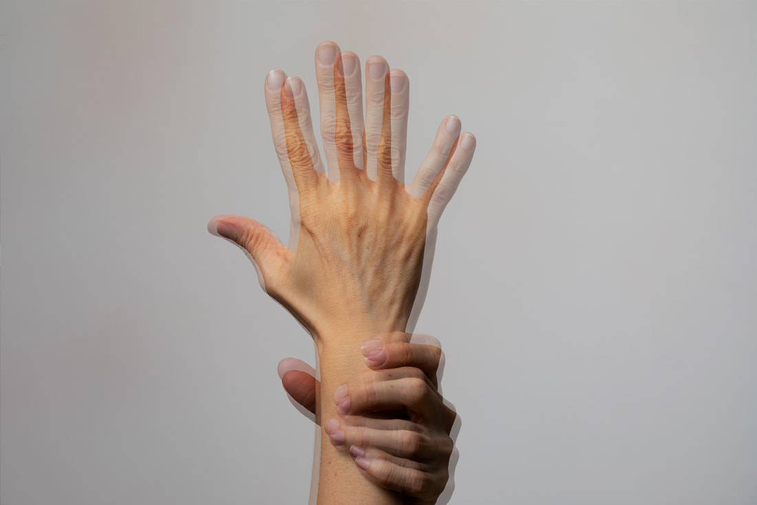 Diplopia or double vision eye condition